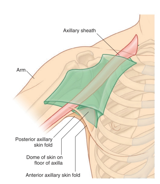 Axillary Region Tumor Of The Left Axillary Region And Neurovascular