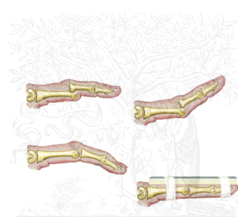 interphalangeal joints