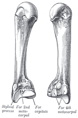 Metacarpal bones