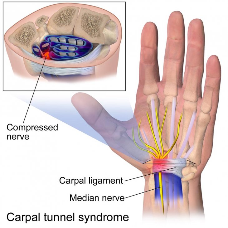 flexor digitorum profundus and superficialis median nerve