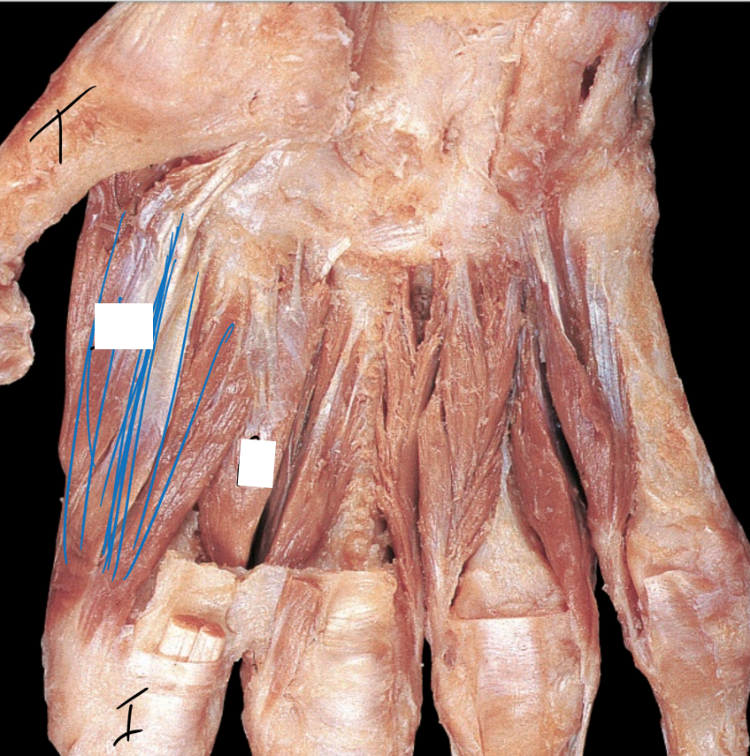 Dorsal Interossei Manus Muscles