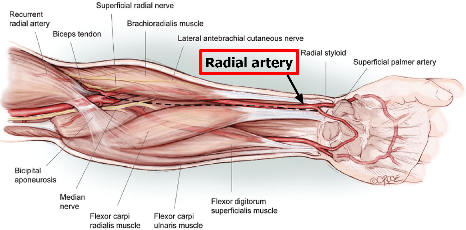 Radial Artery Clinical Notes