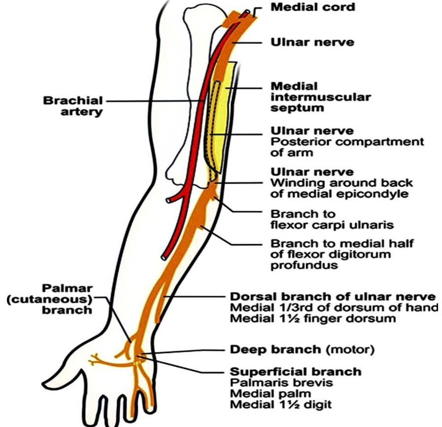 Ulnar (Guyonś) Canal