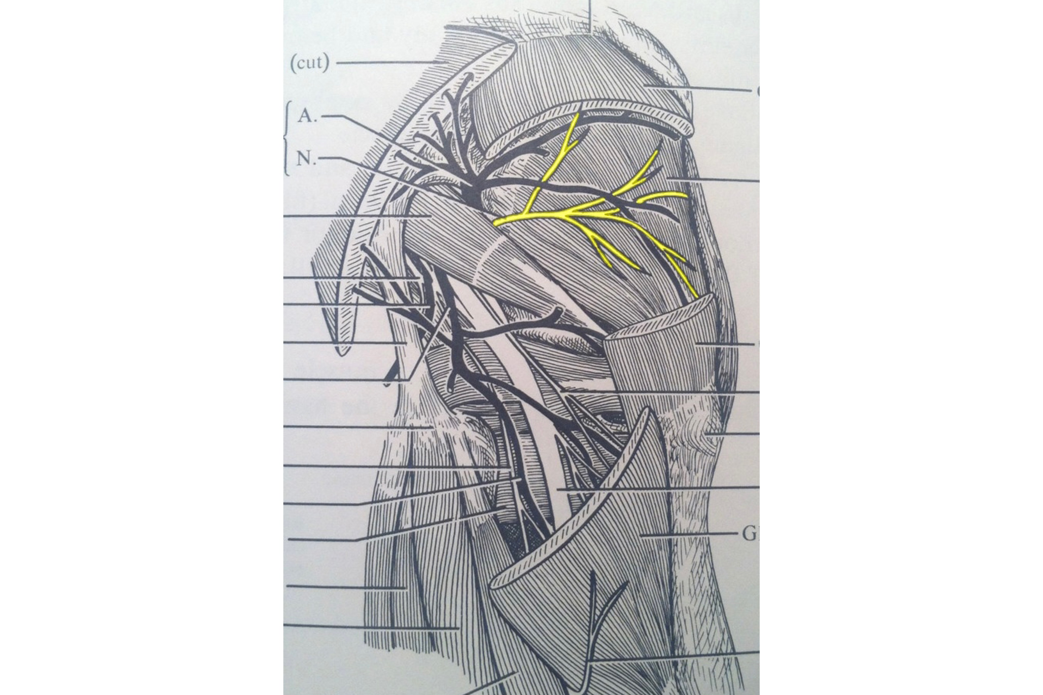 Superior gluteal nerve